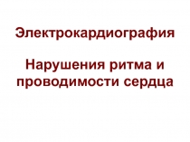 Нарушения ритма.ppt
