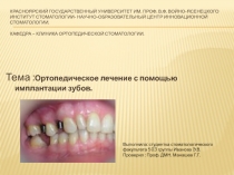 Ортопедическое лечение с помощью имплантации зубов