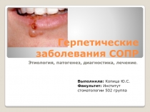 Герпетические заболевания СОПР 