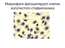 фагоцитоз
