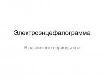 Электроэнцефалограмма В различные периоды сна
