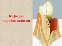 Общие принципы лечения заболеваний пародонта