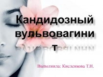 Кандидозный вульвовагинит