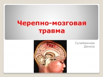 Черепно-мозговая травма