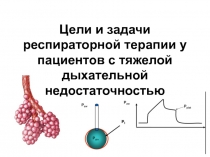 Цели и задачи респираторной терапии у пациентов с тяжелой дыхательной