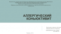 Аллергический коньюктивит