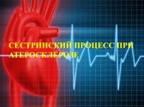 СЕСТРИНСКИЙ ПРОЦЕСС ПРИ АТЕРОСКЛЕРОЗЕ