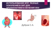 ИСПОЛЬЗОВАНИЕ ИПП РАЗНЫХ ПОКОЛЕНИЙ В ОИТ ДЛЯ ПРОФИЛАКТИКИ И ЛЕЧЕНИЯ ЖКК