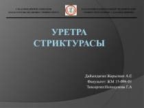 Уретра стриктурасы