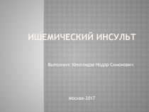 Ишемический инсульт