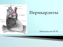 Перикардиты Мамадкулов М М