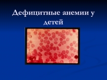 Дефицитные анемии у детей