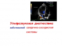 Ультразвуковая диагностика заболеваний СЕРДЕЧНО-СОСУДИСТОЙ СИСТЕМЫ