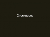 Отосклероз