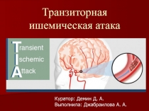 Транзиторная ишемическая атака