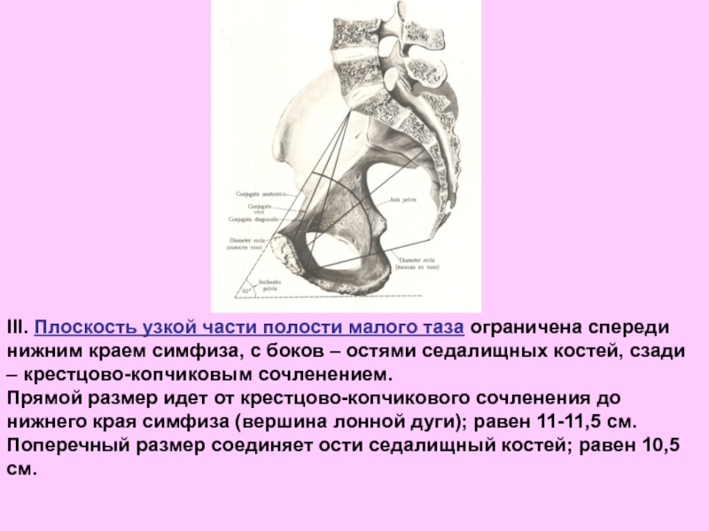 Размеры женского таза презентация