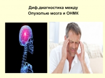 Диф.диагностика между
Опухолью мозга и ОНМК