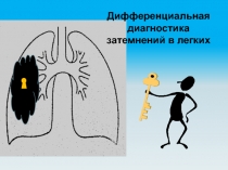 Дифференциальная диагностика затемнений в легких