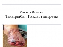 Колледж Даналык Тақырыбы: Газды гангрена