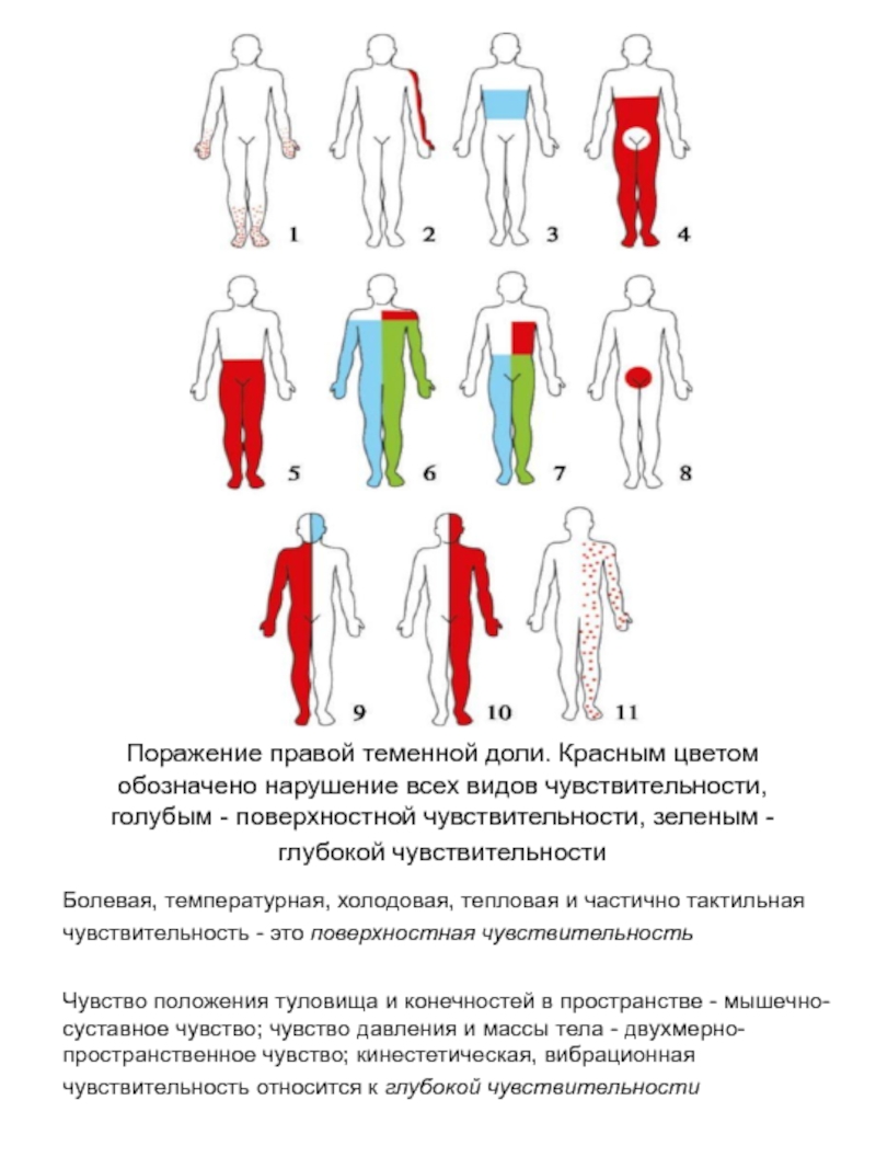 Типы поражения чувствительности. Нарушение чувствительности. Расстройства чувствительности. Нарушение чувствительности по типу. Типы нарушения чувствительности неврология.