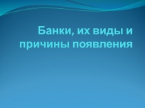 Банки, их виды и причины появления