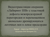 Видеотрансляция операции Лабиринт IIIB  с пластикой дефекта межпредсердной