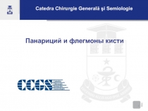 1
Панариций и флегмоны кисти
Catedra Chirurgie General ă şi Semiologie