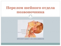 Перелом шейного отдела позвоночника
