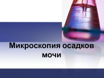 Микроскопия осадков мочи