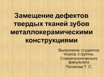 Замещение дефектов твердых тканей зубов металлокерамическими конструкциями