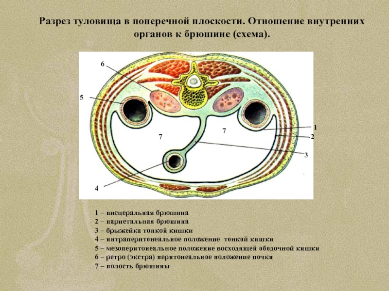 Поперечный разрез через сальниковую сумку схема - 84 фото