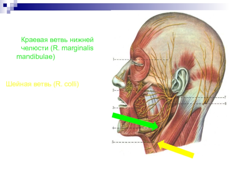 Лицевой нерв челюсти. Краевая ветвь нижней челюсти. Лицевой нерв нижней челюсти. Краевая ветвь лицевого нерва. Неврит лицевого нерва презентация.