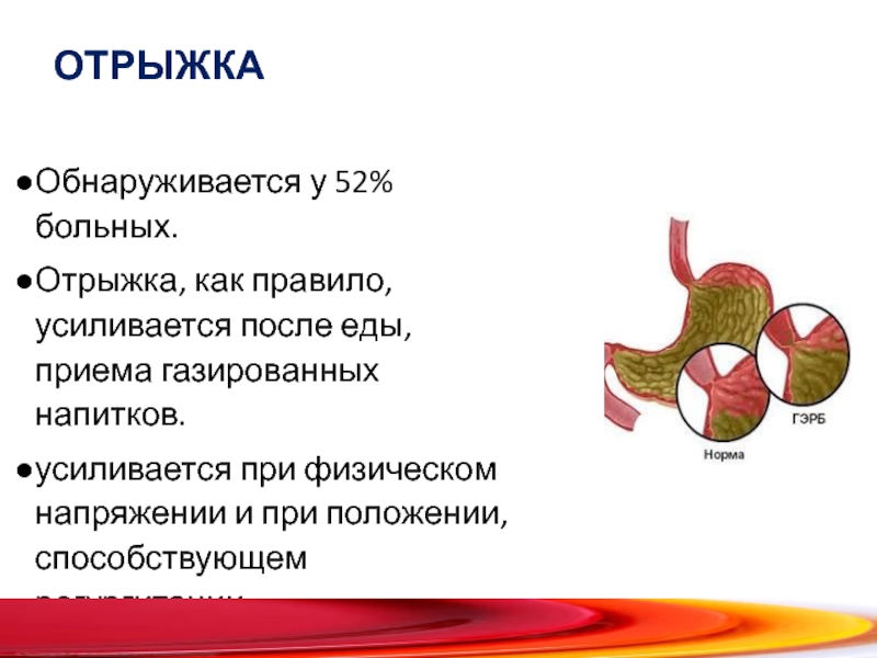 Отрыжка причины. Отрыжка после еды. Отрыжка рыгание. Отрыжка после газированных напитков. Как называется отрыжка.