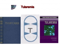 Туляреми́я8948849158048996359