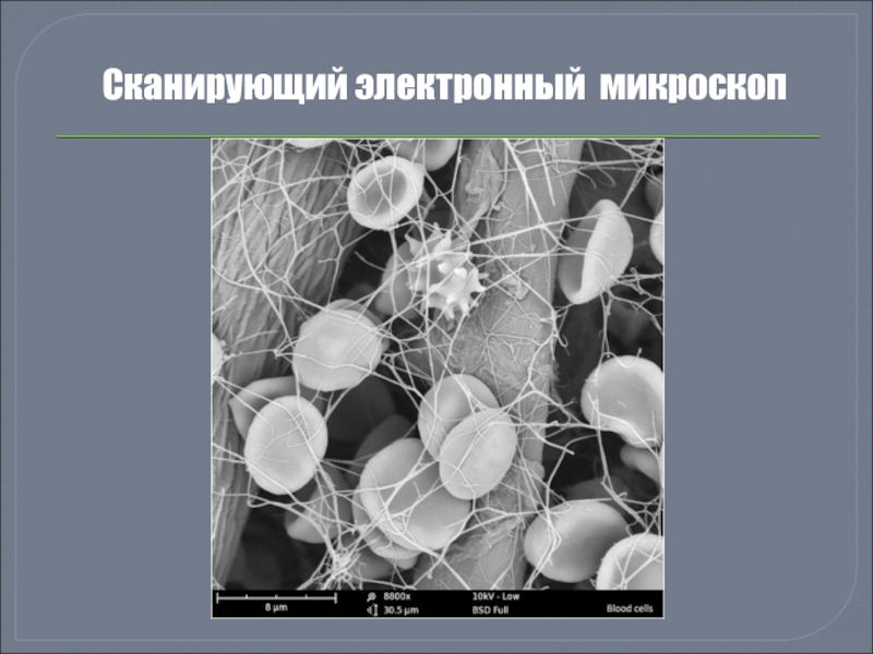 Электронная микроскопия. Сканирующая электронная микроскопия. Растровая (сканирующая) электронная микроскопия. Просвечивающая Растровая (сканирующая) электронная микроскопия. Метод сканирующей электронной микроскопии.