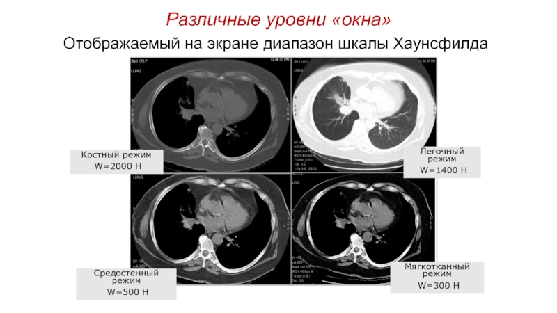 Итеративная реконструкция кт изображений