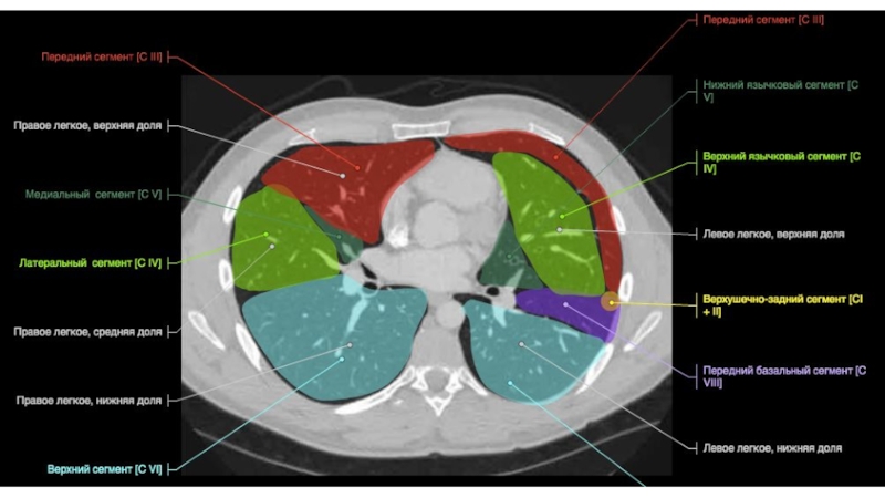 Сегменты легких кт схема