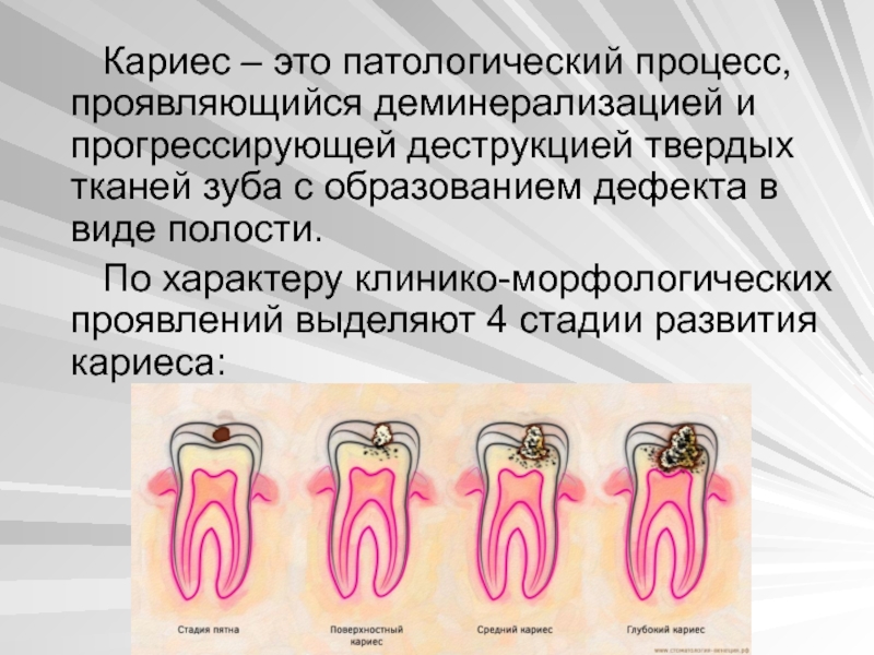 Проект по кариесу