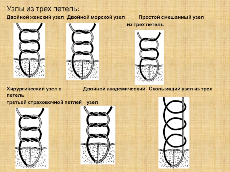 Узелки у женщин. Хирургический узел. Морской хирургический узел. Двойной морской узел. Женский морской и хирургический узлы.