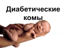 Диабетические комы