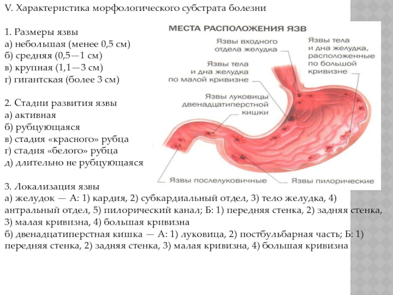 Слизистая рубца. Эндоскопическая классификация язвы ДПК. Язва кардиального отдела. Язва желудка стадии для диагноза.
