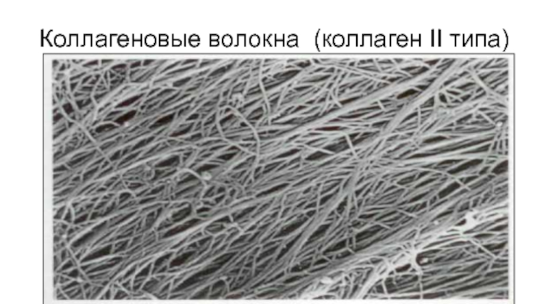 2 эластин. Коллагеновые волокна в костной ткани. Коллагеновые волокна 2 типа это. Коллагеновые волокна микроскопия. Коллагеновые волокна 1 и 2 типа.