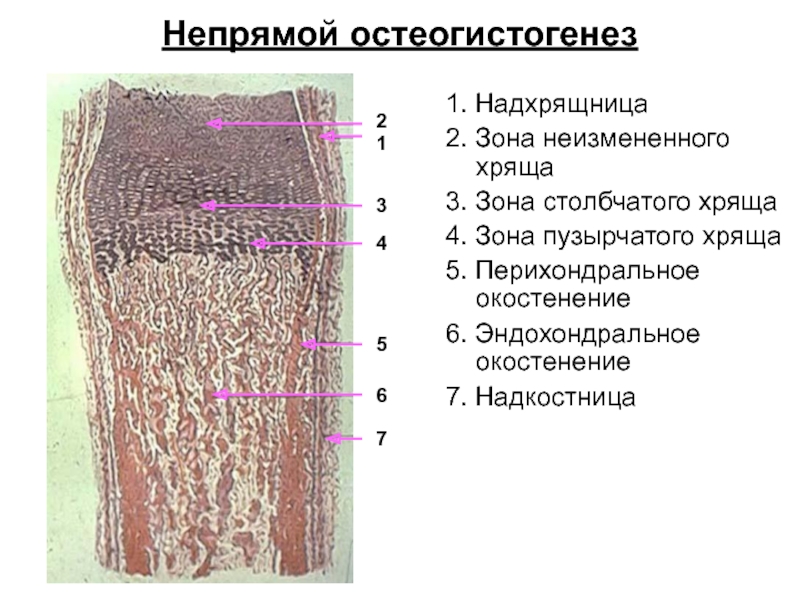 Схема непрямого остеогенеза гистология