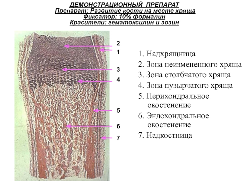 Развитие кости на месте хряща гистология рисунок