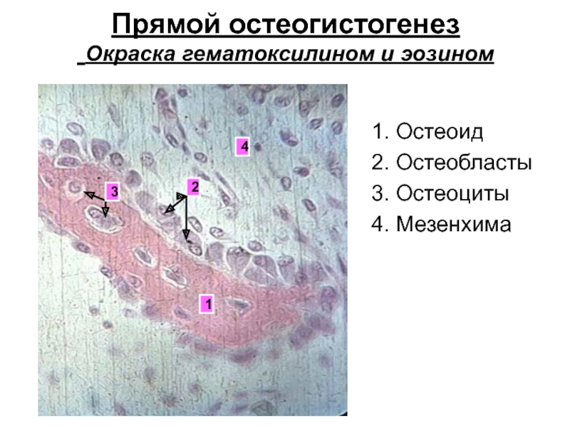 Прямой остеогенез гистология рисунок