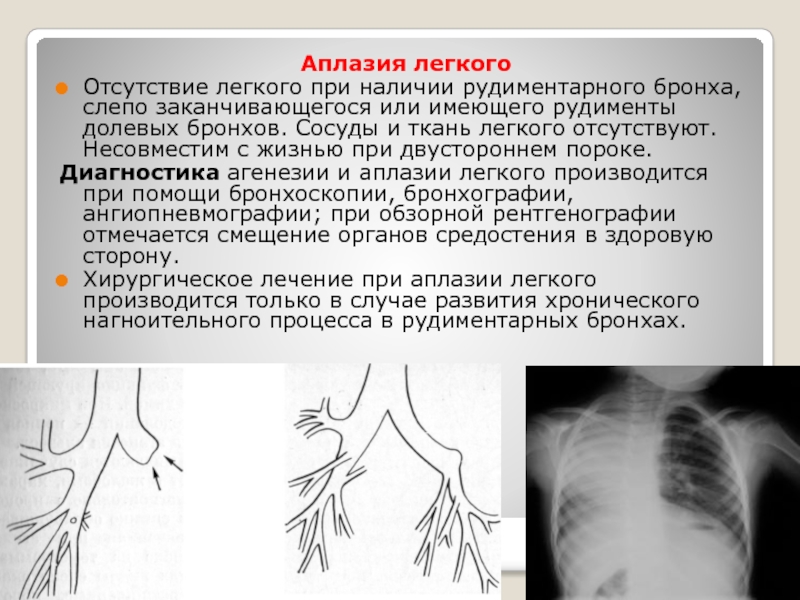 Аплазия это в медицине