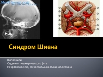 Синдром Шиена