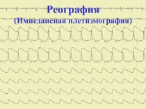 Реография
(Импедансная плетизмография)
