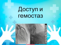Доступ и гемостаз