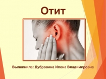 Отит
Выполнила: Дубровина Илона Владимировна